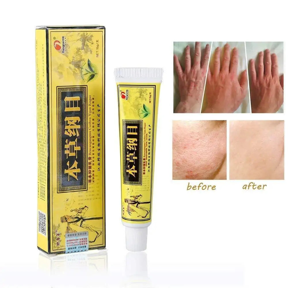 Eczema Natural Herbal Cream GTPD Global Trending Products Direct