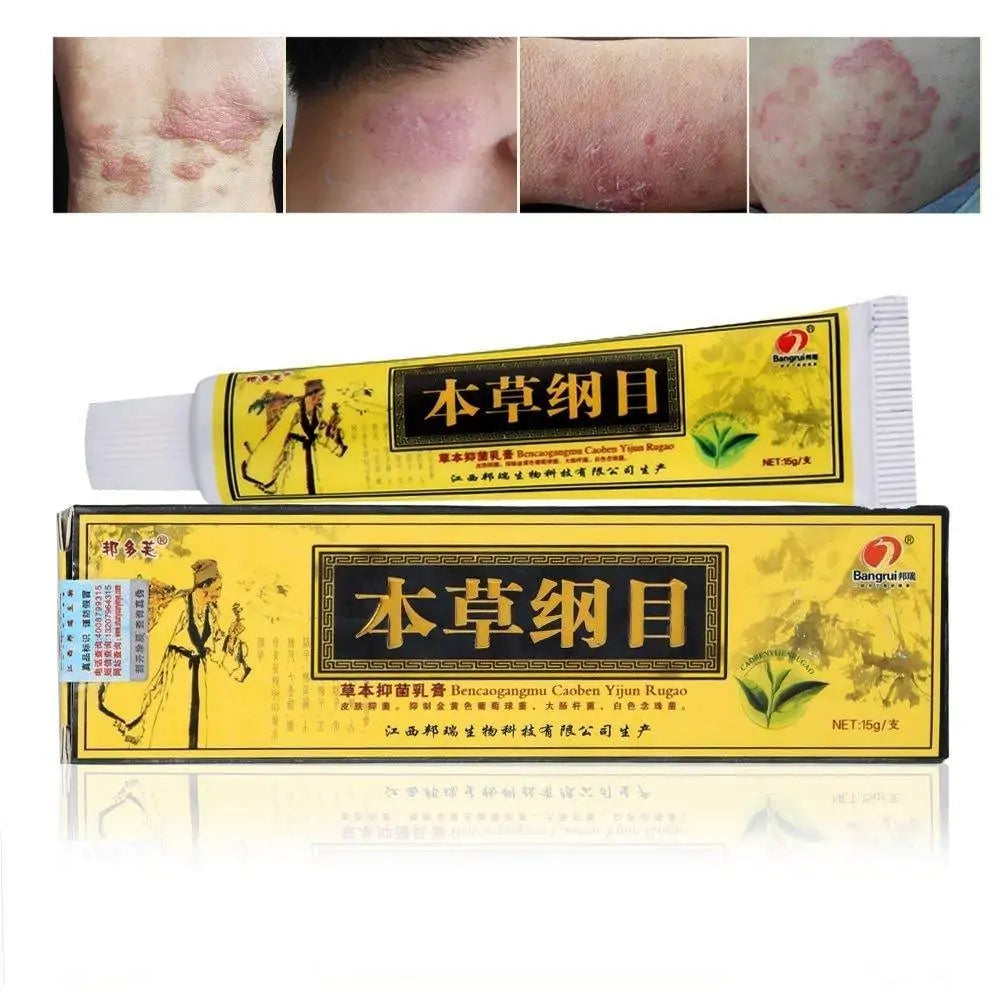 Eczema Natural Herbal Cream GTPD Global Trending Products Direct