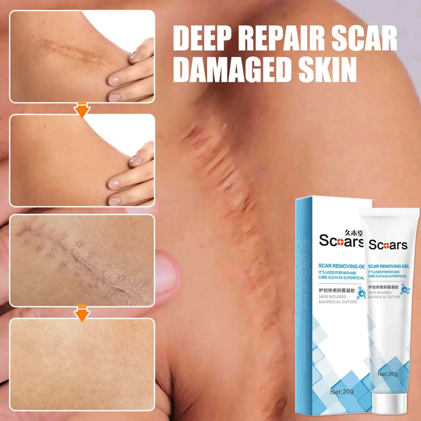 New Herbal Scar Repair Cream GTPD Global Trending Products Direct