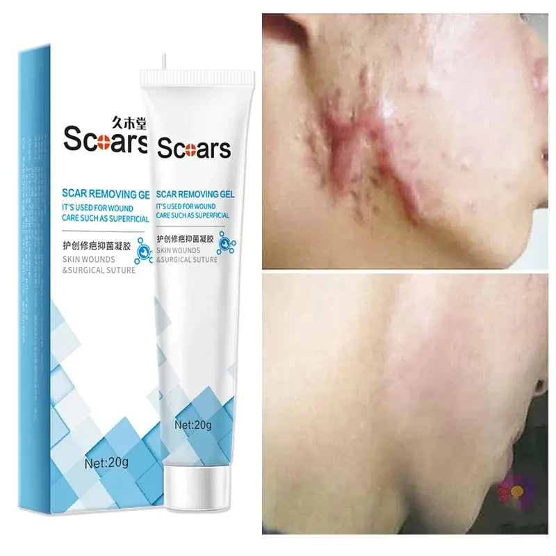 New Herbal Scar Repair Cream GTPD Global Trending Products Direct