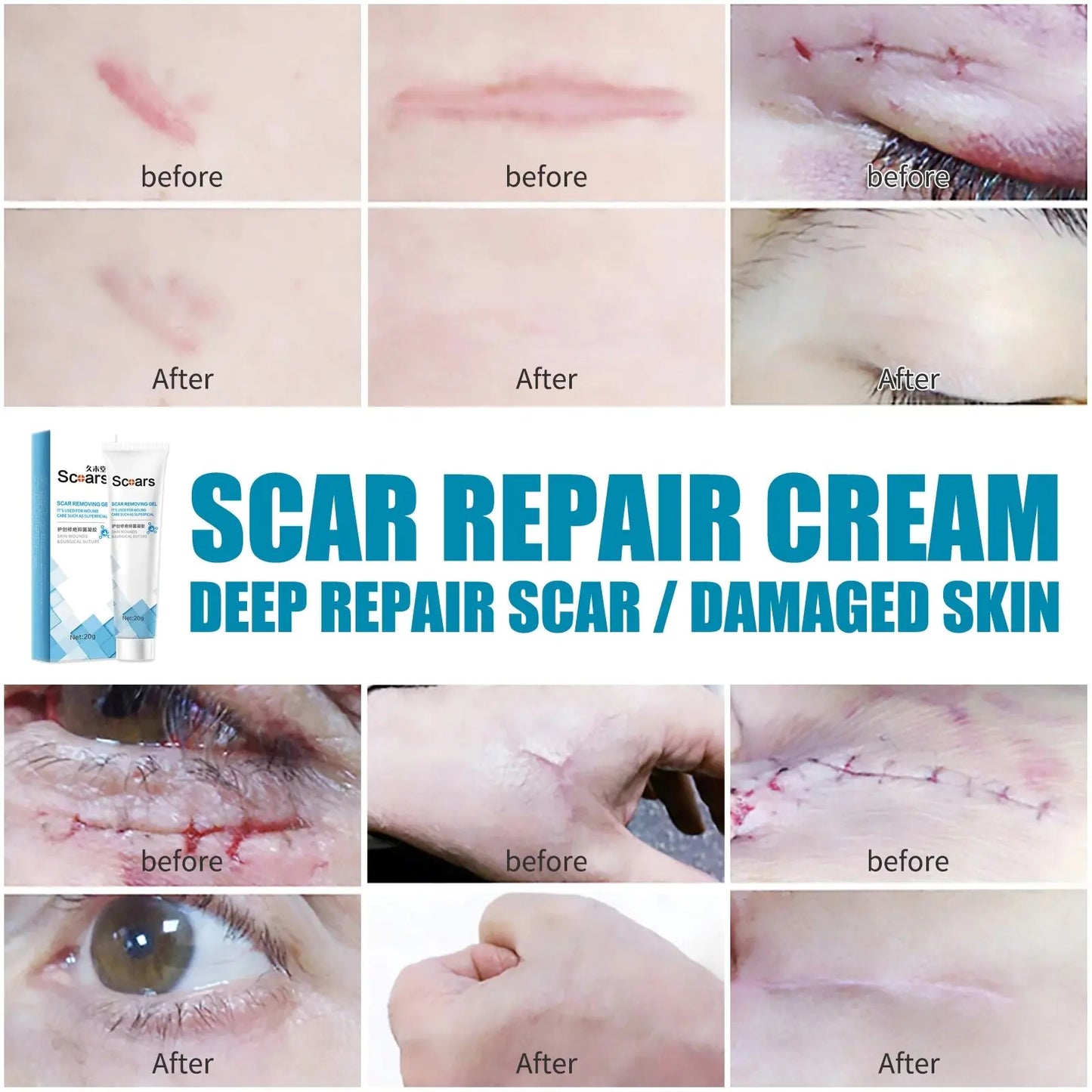 New Herbal Scar Repair Cream GTPD Global Trending Products Direct