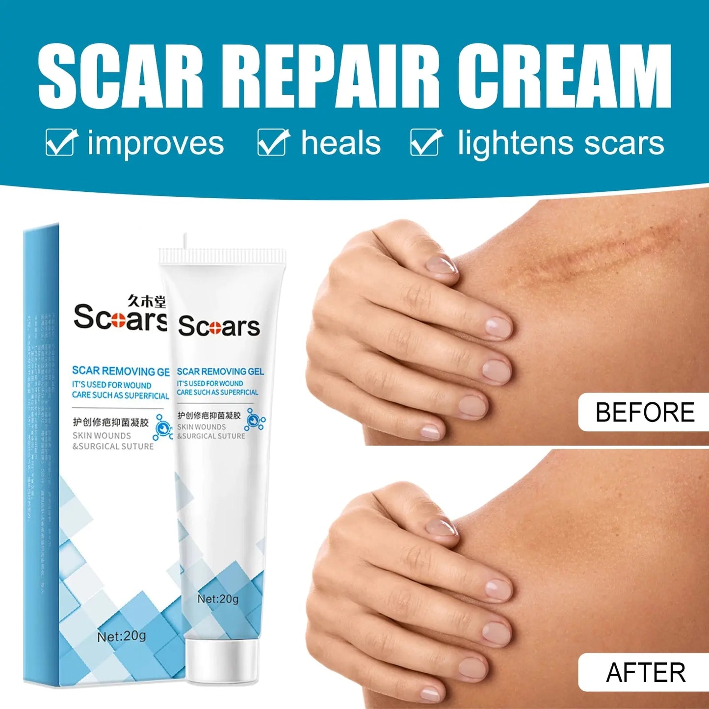 New Herbal Scar Repair Cream GTPD Global Trending Products Direct